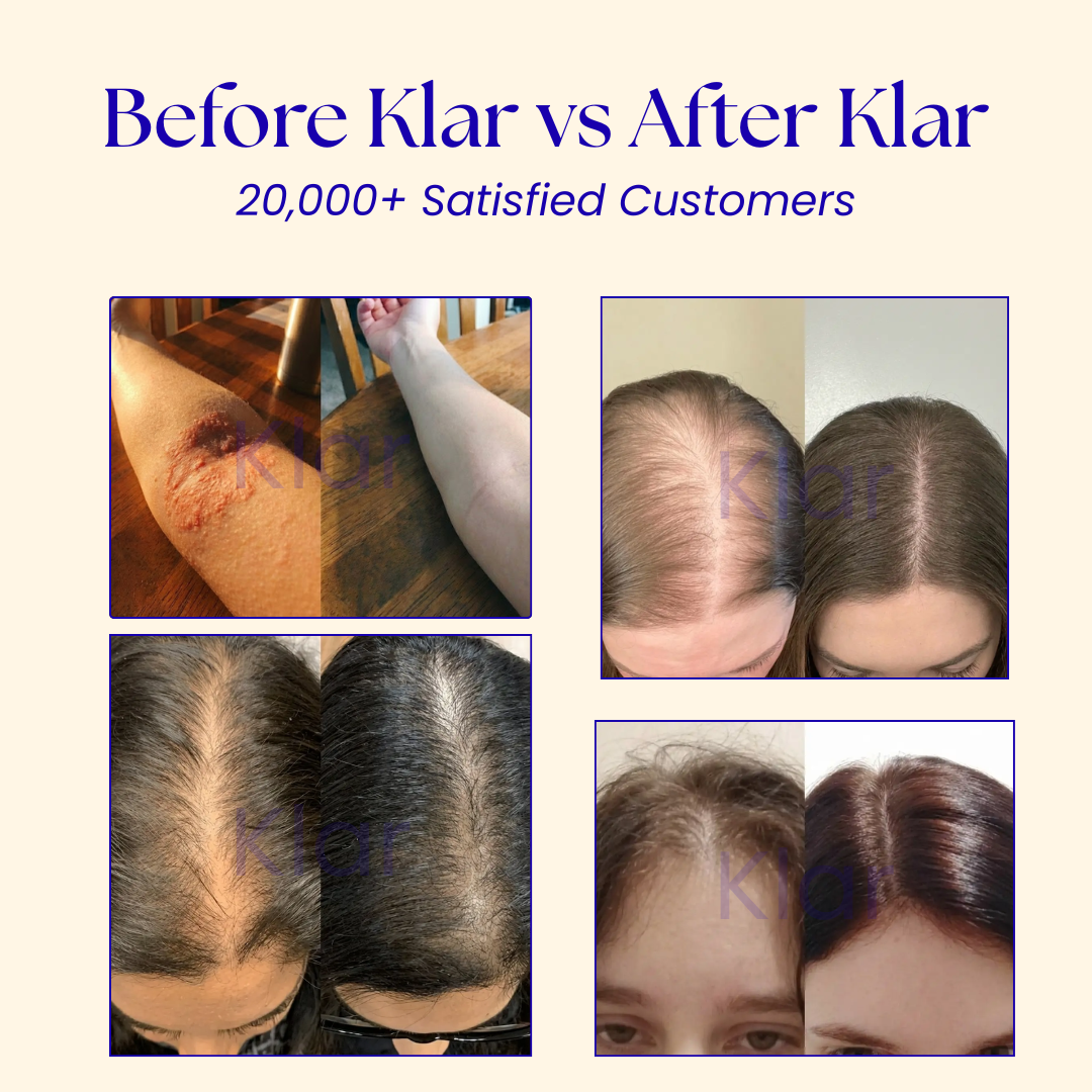 Klar™ Shower head