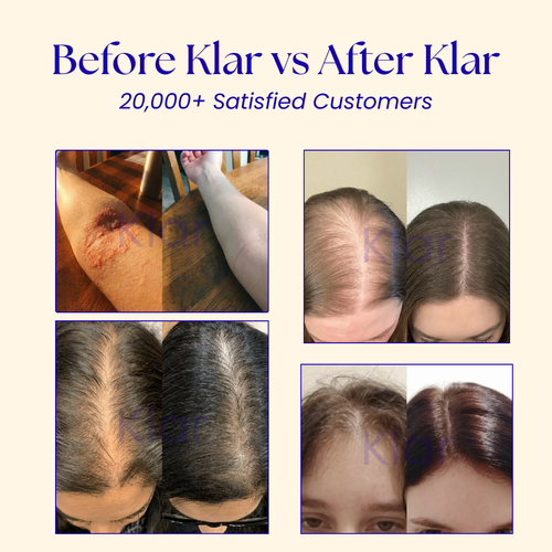 Klar™ Shower head